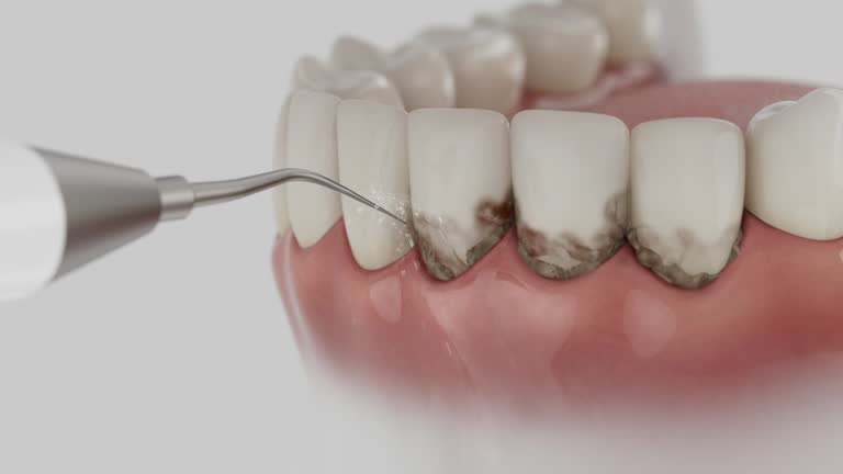Reliable Dental Crowns And Bridges contractor in Lincoln County County, WV by Dentist Open Now